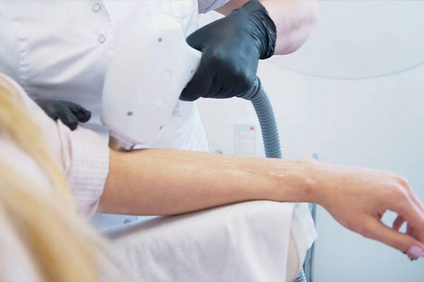 什么是強(qiáng)脈沖光（IPL）